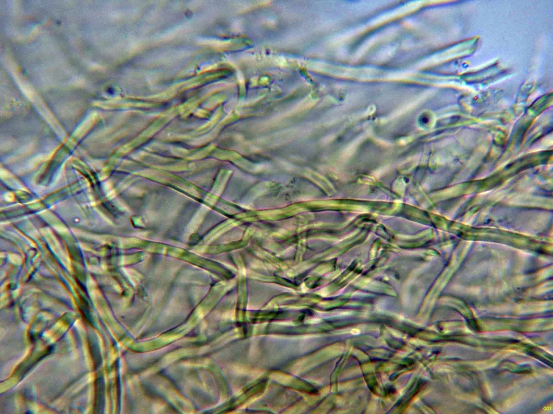 Brunneoporus kuzyanus 10 - Hifas Melzer-001